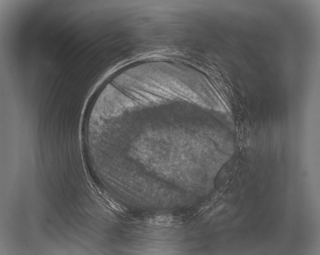 X0000081560196200702121404