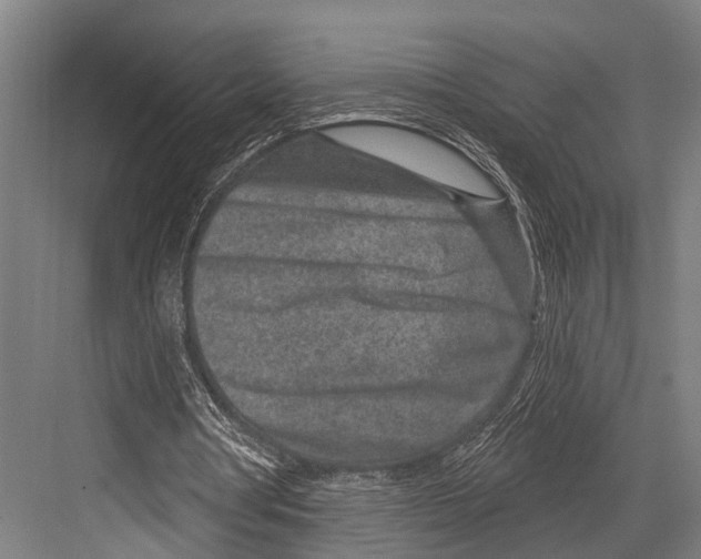 X0000081560386200702121401