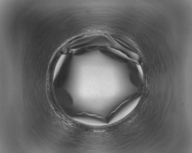X0000081560388200702121401