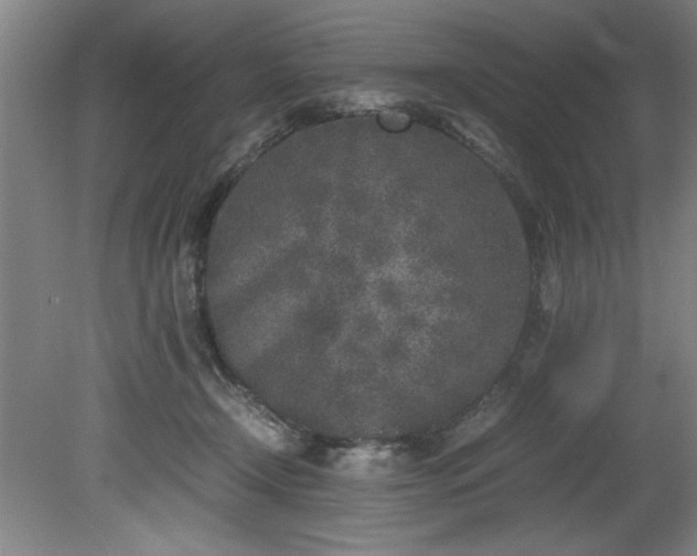 X0000081570366200701221059