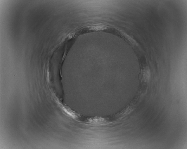 X0000081570517200701221056