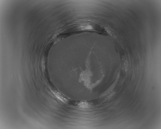 X0000081570562200701221056