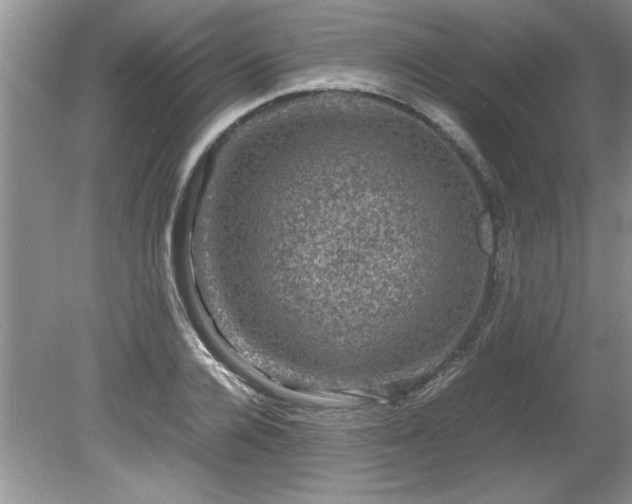 X0000081570936200701221049