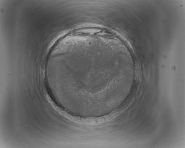 X0000081570015200702051225