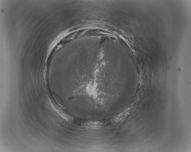 X0000081570152200702051223