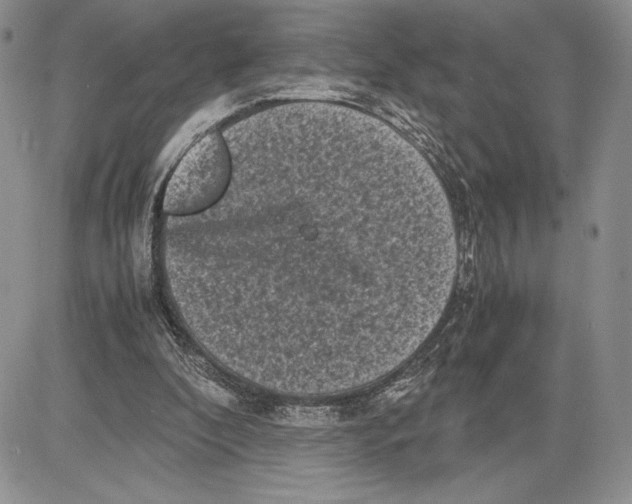 X0000081570296200702051221