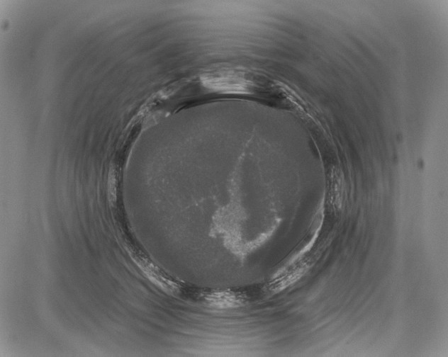 X0000081570562200702051217