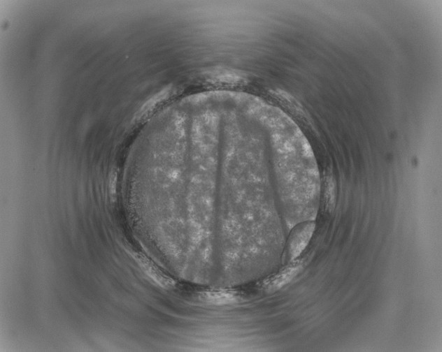 X0000081570668200702051215