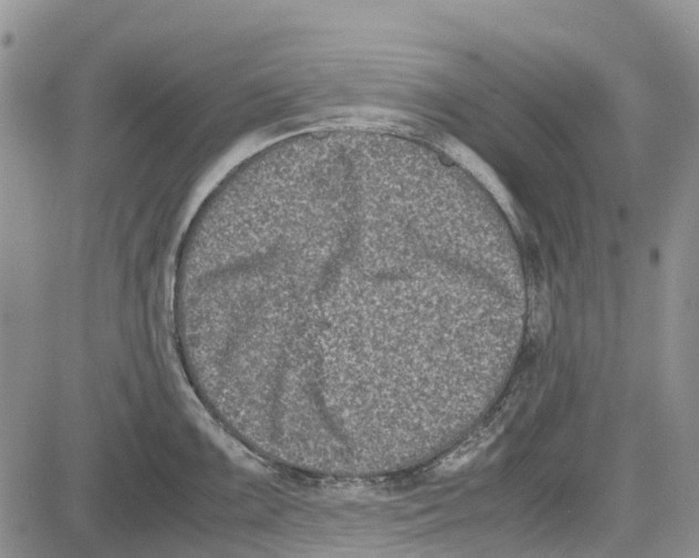 X0000081571099200702051208