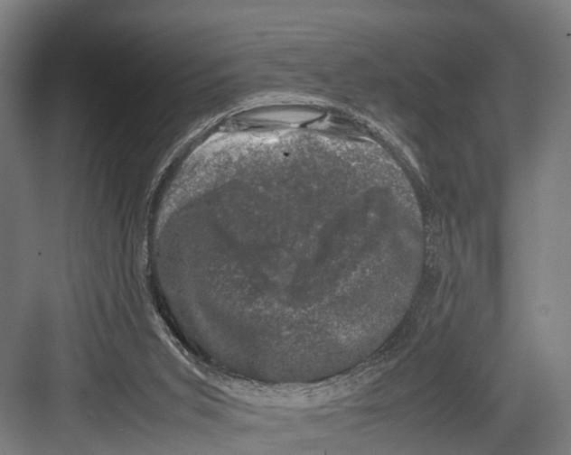 X0000081570015200702121433