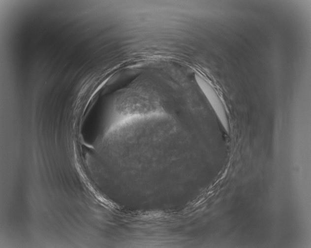 X0000081570097200702121432