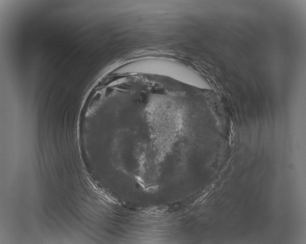 X0000081570148200702121430