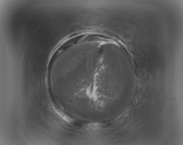 X0000081570152200702121431