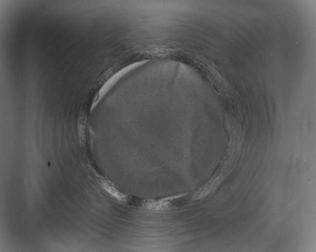 X0000081570576200702121425