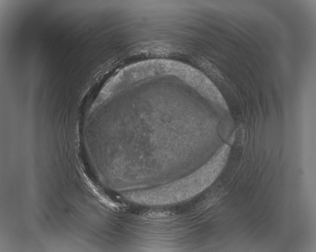 X0000081570638200702121423