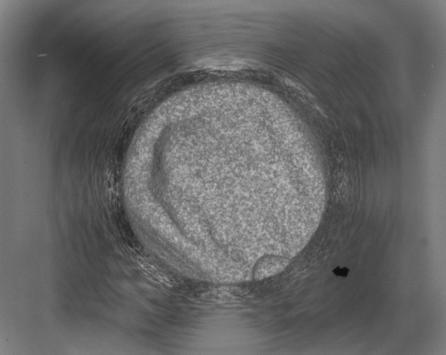 X0000081570966200702121417