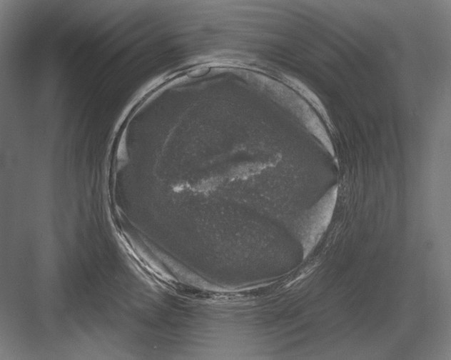 X0000081571146200702121415