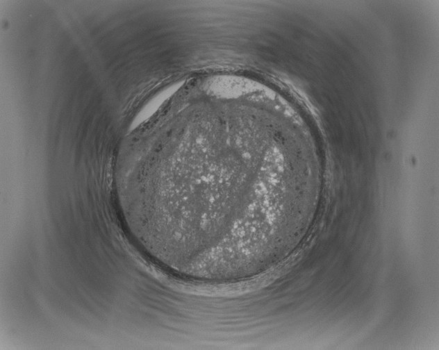 X0000081580017200702051250