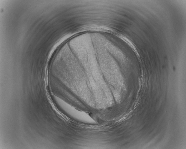 X0000081581128200702051232