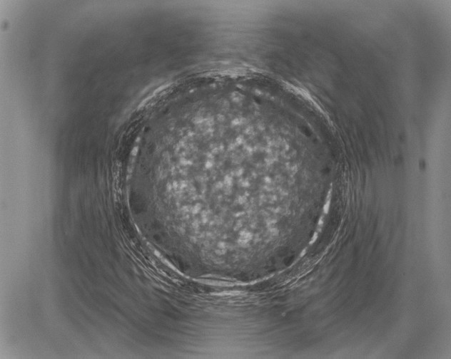 X0000081581399200702051227