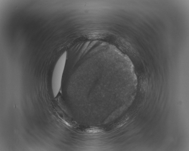 X0000081580219200702121456