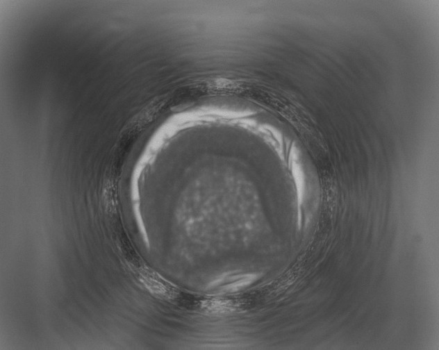 X0000081580419200702121452