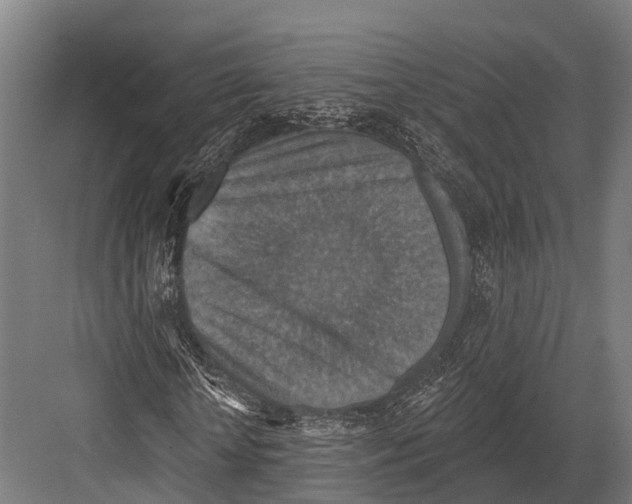 X0000081580818200702121445