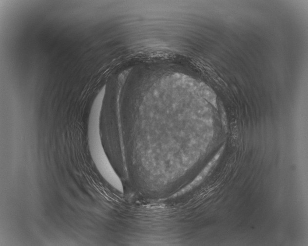 X0000081580916200702121443