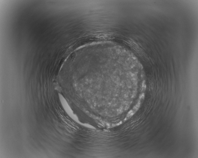 X0000081581106200702121440