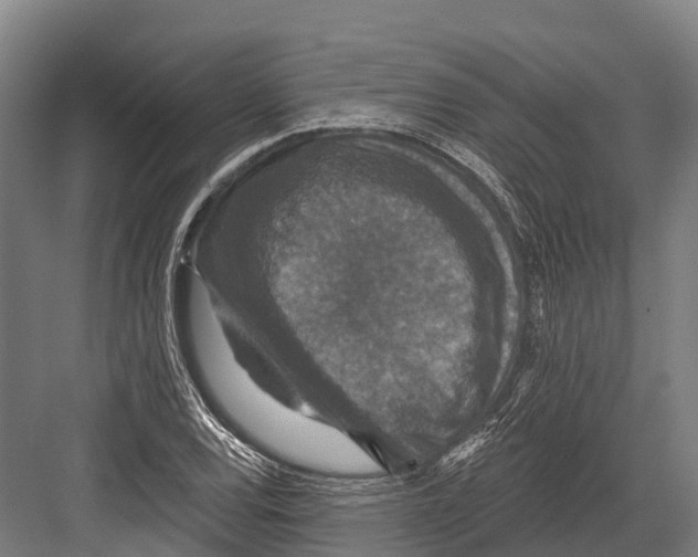 X0000081581120200702121440