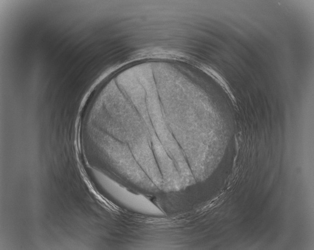 X0000081581128200702121441