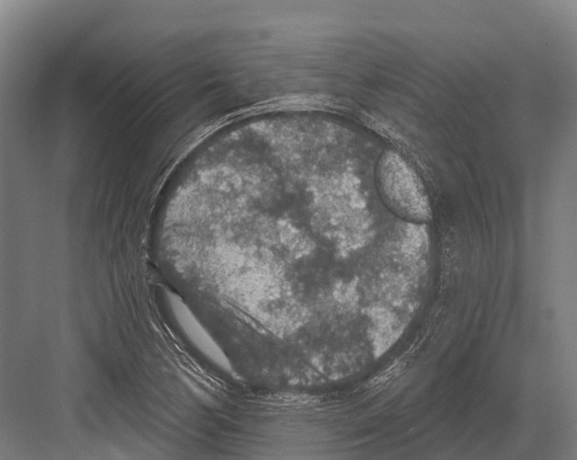 X0000081581170200702121440