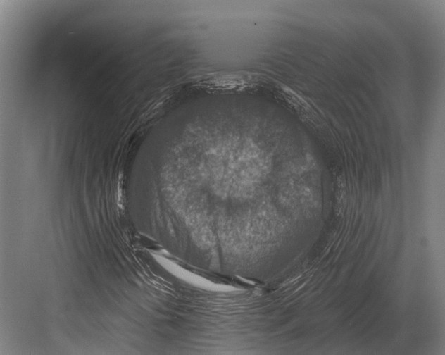 X0000081581394200702121435