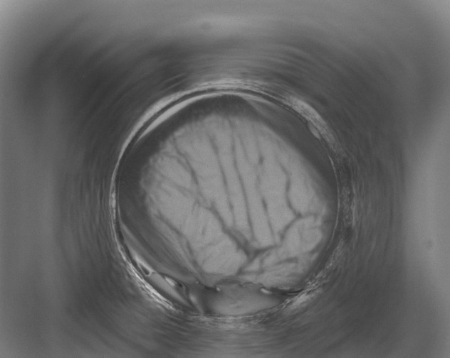 X0000081581428200702121436