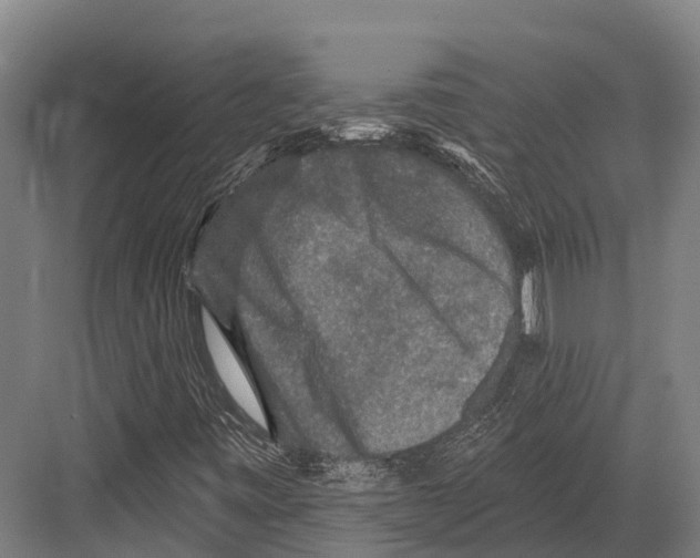 X0000081581443200702121435