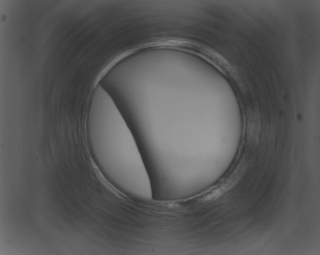 X0000081591417200701151014