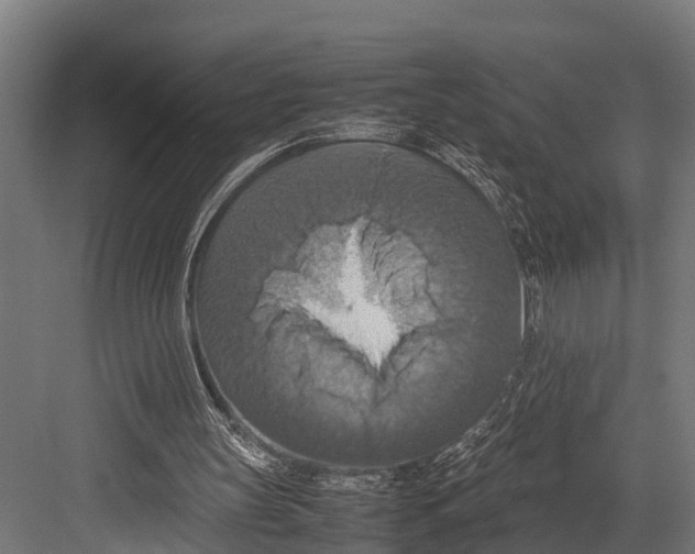 X0000081590147200702121523