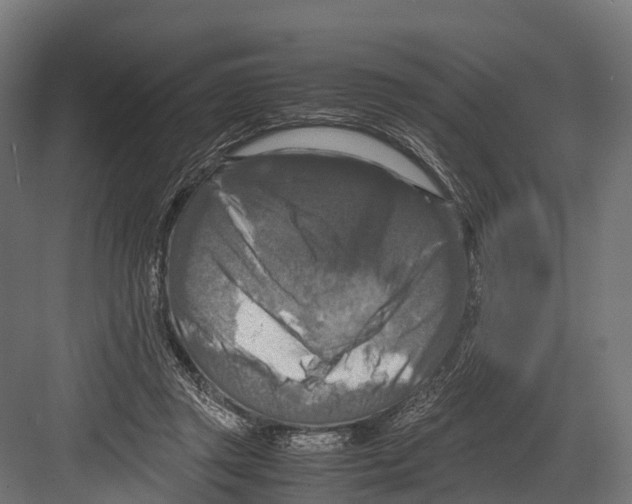 X0000081590357200702121520