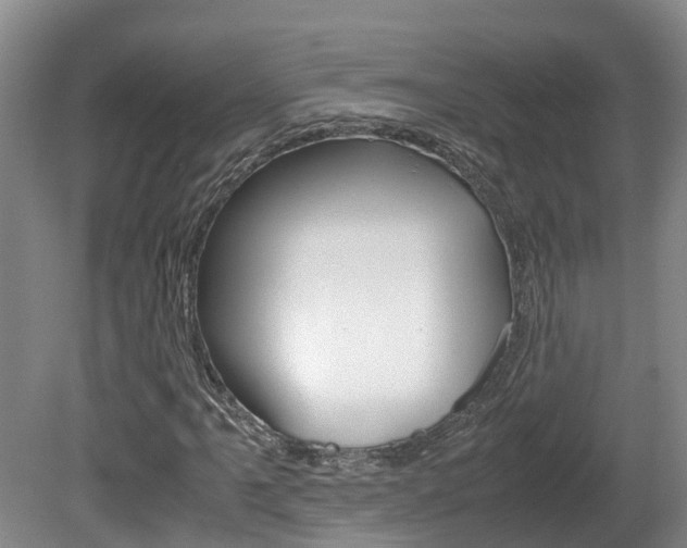 X0000081611061200701151114