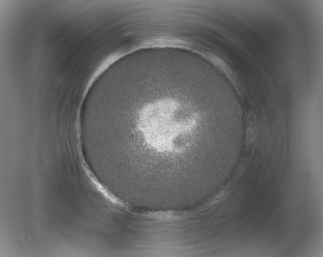 X0000081610990200701151400