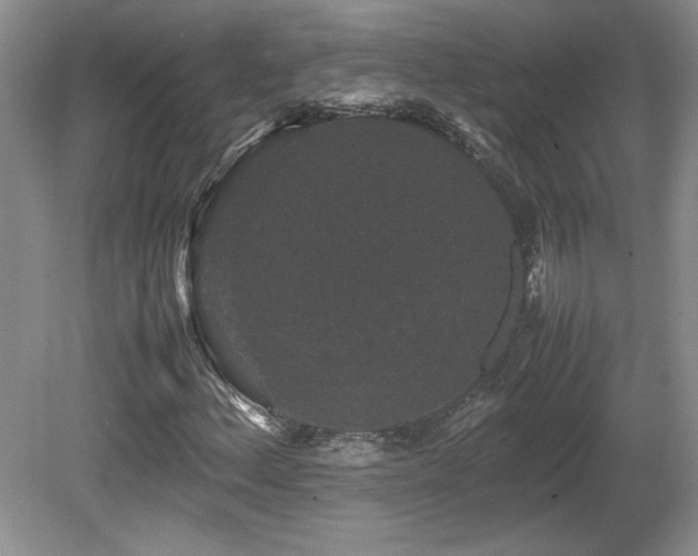 X0000081611156200701151358