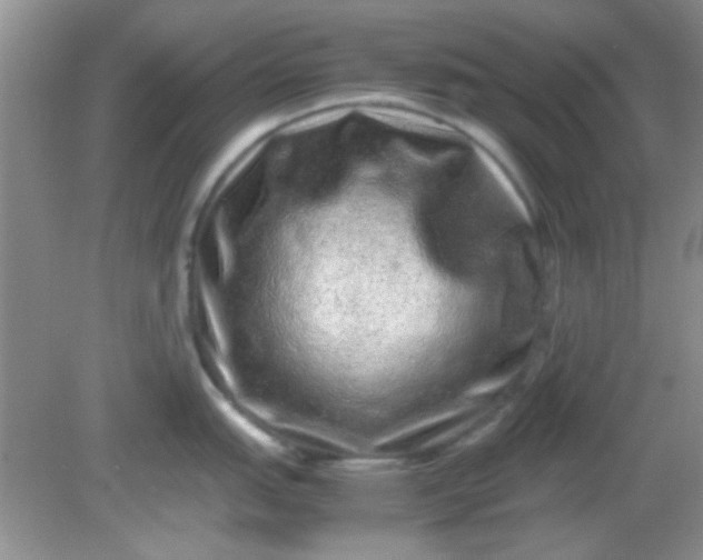 X0000081611151200701291420