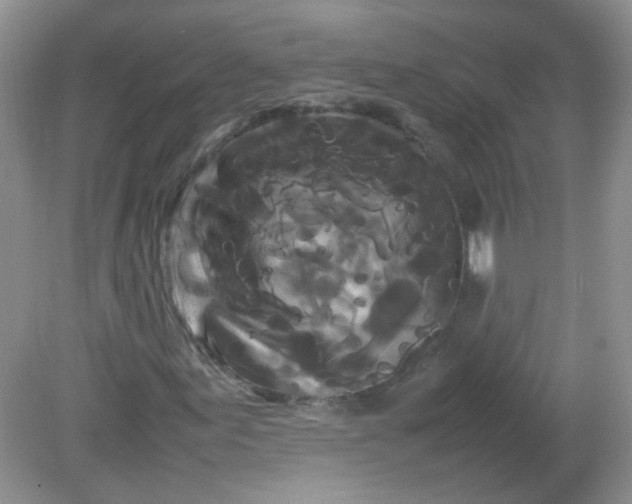 X0000081611155200701291420