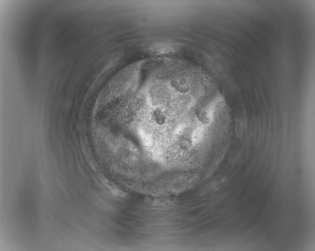 X0000081611393200701291415