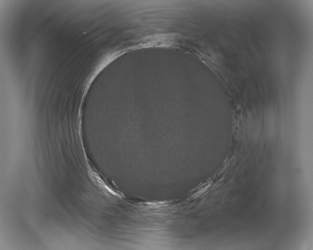 X0000081620100200701151442