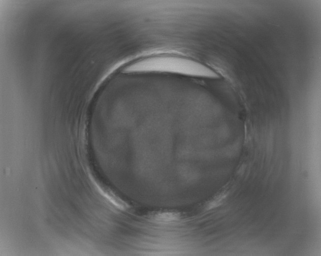 X0000081620156200702051242