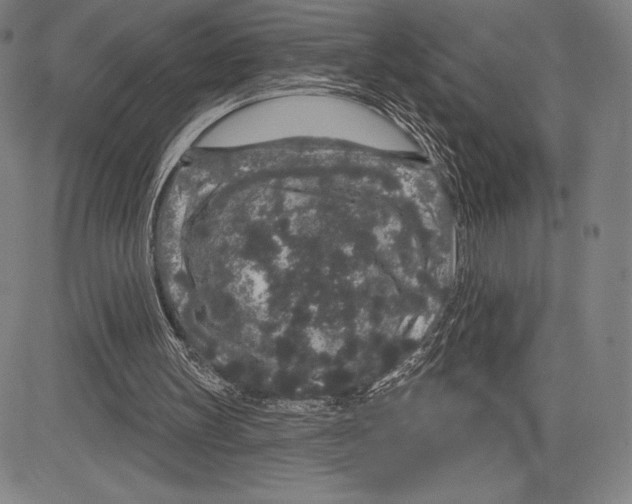 X0000081620147200702121648