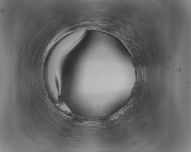 X0000081620150200702121648