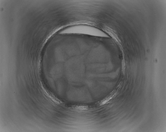 X0000081620156200702121648