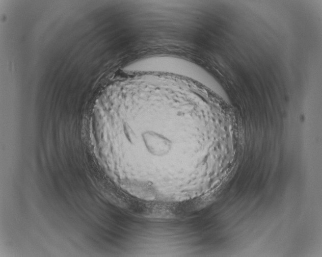 X0000081620175200702121649